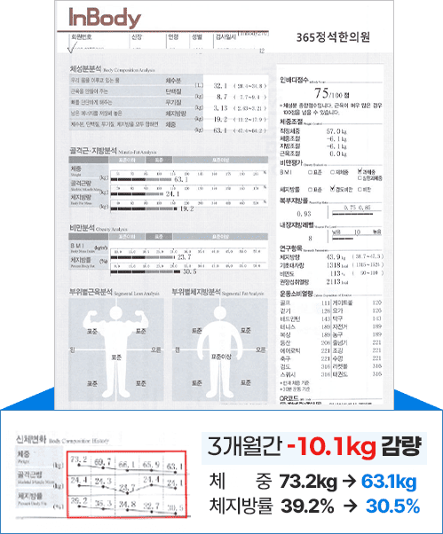 3개월간 -10.1kg 감량 사례